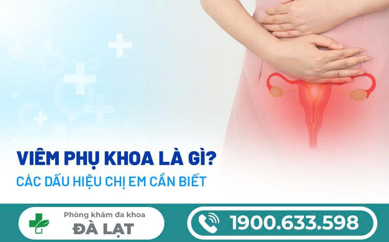 Hình ảnh minh họa